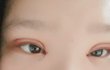 나 쌍수 망한거같아?ㅋㅋㅋㅋ ㅠㅠㅠ