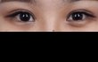 쌍수 의사쌤이 잡아주는 라인있자나 제발 드루와