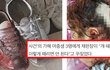 학교 폭력가해자 천벌 받음 (사진 있음)