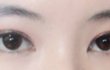 (수정)쌍수했어옇ㅎㅎㅎ