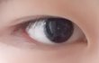 쌍수 후기