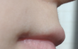 입술 어떻게 해야 할까요ㅠㅠㅠ
