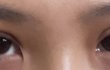 쌍수 라인 좀 봐줘ㅠㅠ