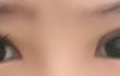 ㅠㅠ눈매교정 붓기..짝짝이..ㅠㅠ?
