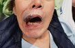 거동도 못하시는 시아버지를 간병인이 마구 때렸어요..