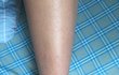 (혐주의) 나 종아리 왜 이래?