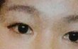 이마보톡스맞고 눈매가변했어 ㅜ ㅜ