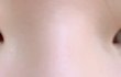 [조언부탁해]쌍수할까말까