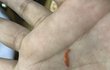 대구 칠곡 엽기떡볶이에서 손톱나온후기