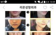 ㅋㅋㅋ강남언니 윤곽주사후기보는데