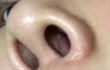 ㅇ