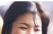 ㅎㄱ성형