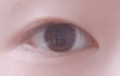쌍수 성공할까??