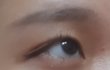 쌍수상담