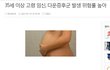 35세 여성과 결혼하는 분 보세요