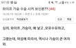 본인 아내 가슴수술시키려는 남편;