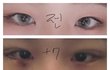 애들아 나 쌍수했는데 봐주라