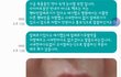 이건 의료사고 아닌가요? 병원측은 사과조차안합니다.(협오사진있습니다.)