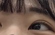 나 쌍수 재수술할까