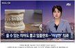 멀쩡한 치아까지 임플란트 시술한 치과 원장