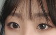 +)++)쌍수 할까 말까