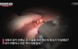 법적 규제가 절실해 보이는 콧대 필러 부작용 “실명 사례”