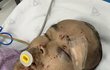 (사진있음/수정) 폐쇄 정신병동에서 조현병 환자에게 저희 삼촌이 폭행당해 뇌사 상태에 있습니다 한번만 읽어주세요