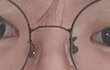 나 쌍수하면 어떨것같아?