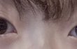 추가)) 이거 냅두면 쌍커풀 생겨...?ㅠㅠ