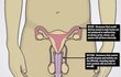 남사친이 소변 보다가 피 나와서 병원 갔다왔다는데