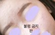 피부 좋아지구 싶지 ?