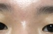 내년에 쌍수하는데 괜찮은 눈인지 봐줘