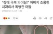 환자 아들에게 폭행당한 치과의사