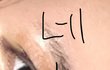 +댓글 내가 안썼어ㅠㅠ//쌍수 후기 들고왔어2 수술 후 사진 있음