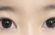 나 처럼 눈 미간 사이 좁으면 어캐함 ?