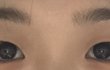 나 쌍수할건데 함만봐줘 젭R