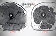 20대와 70대의 허벅지 단면