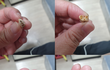 인천 중국집 음식에서 사람 치아가 나왔습니다 (사진O)