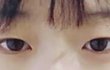 +)미안해 나 쌍수 잘된건지 평가좀 ㅎㅎ