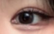 ++앞트임한거ㅠㅠㅠ