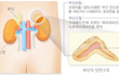 불면증 원인을 알게된 공시생