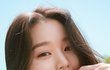 장원영 앞트임 복원