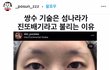 일본이 진짜 쌍수하나는 잘뽑나보다