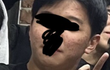 형 누나들 저 피부 거부감 드나요