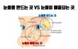 쌍수하고나서 눈물나올때마다 눈이 너무 아파