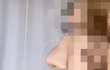 코수술 염증 한번만 봐주라ㅠㅠ!!!