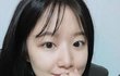 쌍수 상담때 슈화사진 들고가는거 어떻게 생각해?