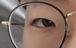 눈 관리가 중요한 이유
