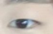 쌍수 1년 반 된 눈 볼래??? (전후있음) + 궁금한 거 물어봐!