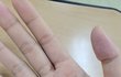 여러분 이거 각질인가요?